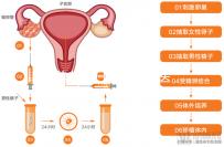 赴美考察歸來！HRC醫(yī)院的6位試管嬰兒醫(yī)生是亮點(diǎn)