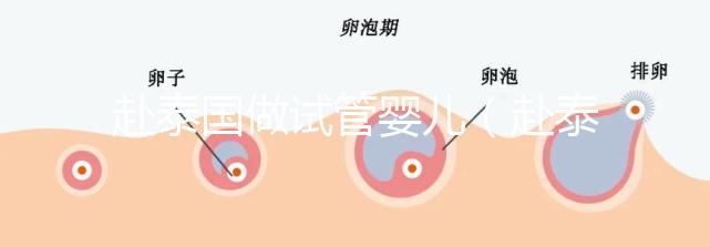 赴泰國(guó)做試管嬰兒(赴泰國(guó)做試管嬰兒要多少錢)