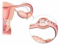 誰說華西二院試管嬰兒成功率不高，那是你沒選對生殖醫(yī)生