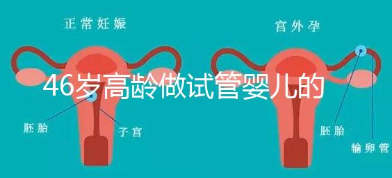 46歲高齡做試管嬰兒的成功幾率有多大？聽聽大家怎么說