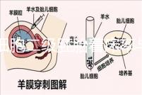 6細胞二級胚胎著床率與養(yǎng)囊成功率解讀,拿不準(zhǔn)移植與否戳
