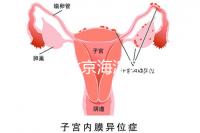2024年北京海淀區新生兒醫療保險處理策略，照片要求不要出錯