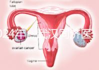 2024年,武漢同濟醫院不孕癥醫生排名公布,選擇專家迅速登記